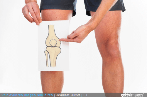 articulation arthrose