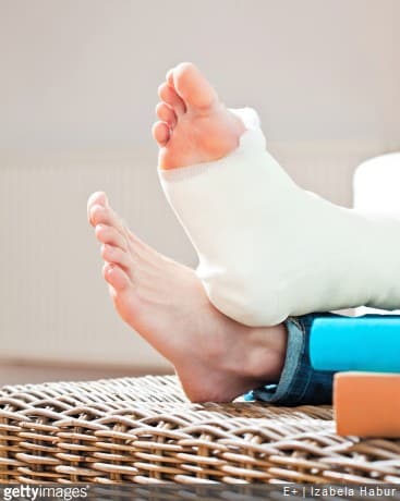 Les entorses les plus graves peuvent nécesité la pose d'un plâtre ou d'une attelle, afin d'immobilier l'articulation blessée.